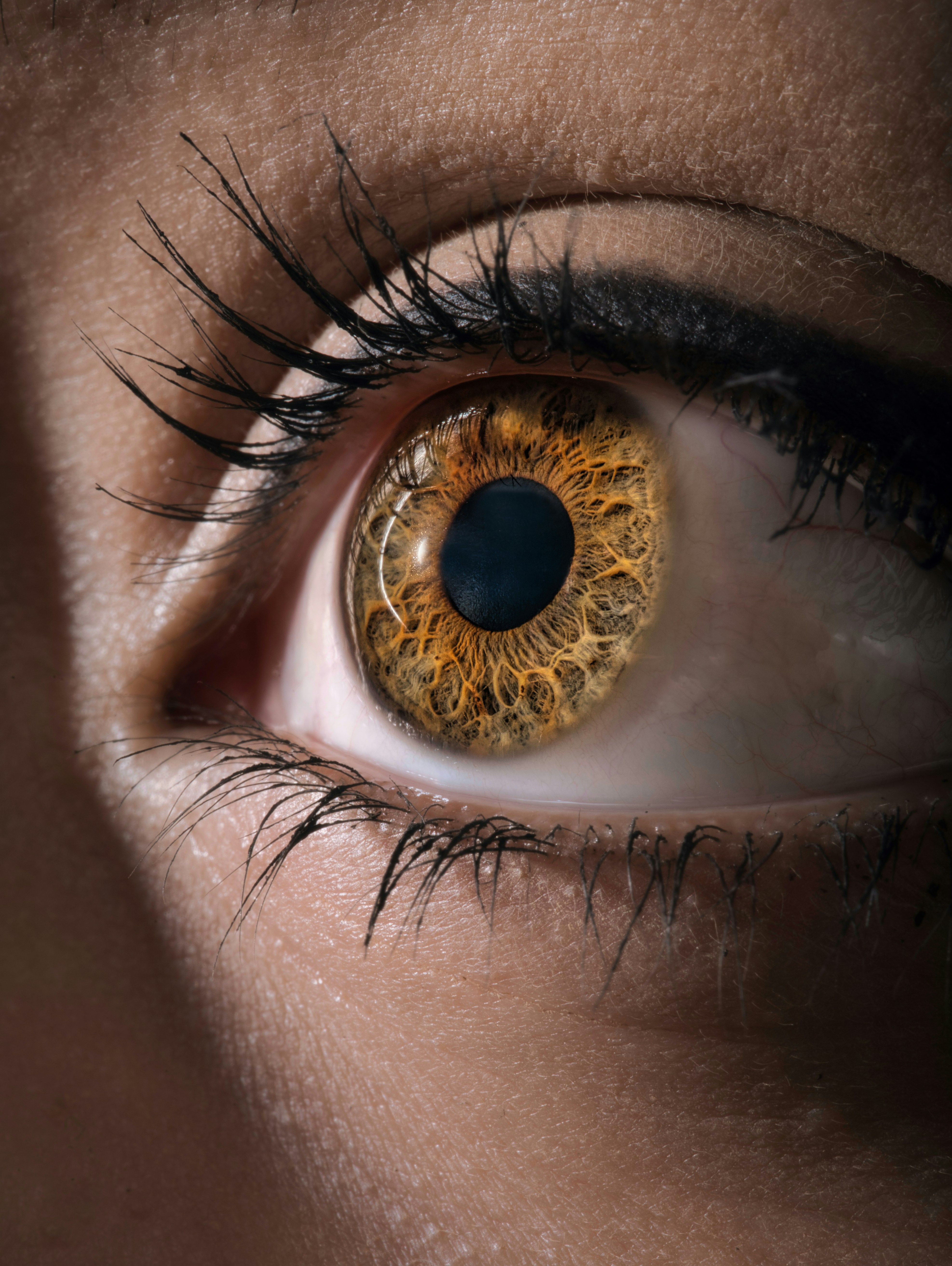 EyePal scleral contact lens for keratoconus