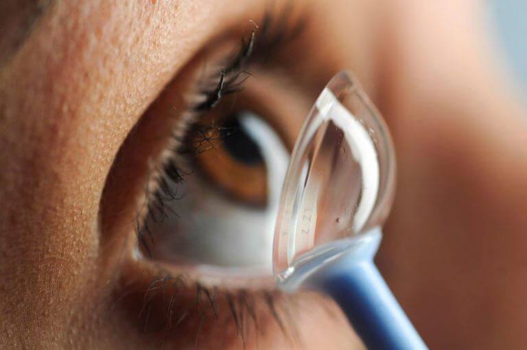 EyePal Keratoconus Scleral lens